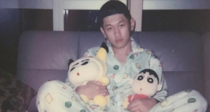 짱구머리 이미지