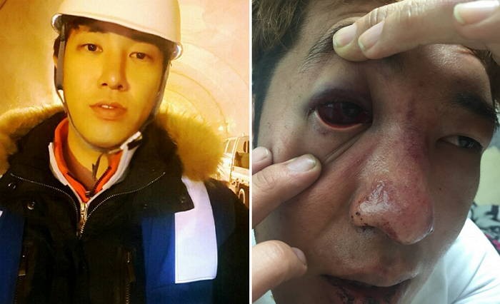 “의대생 친오빠가 외국인들에게 묻지마 폭행 당했습니다”