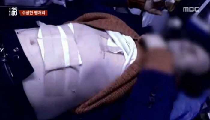 스베누 공장장 “28억 못 받았다”며 회사서 자해 소동