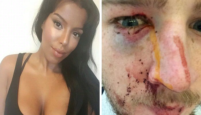 친구에게 집적대는 남학생 ‘하이힐’로 폭행한 여대생