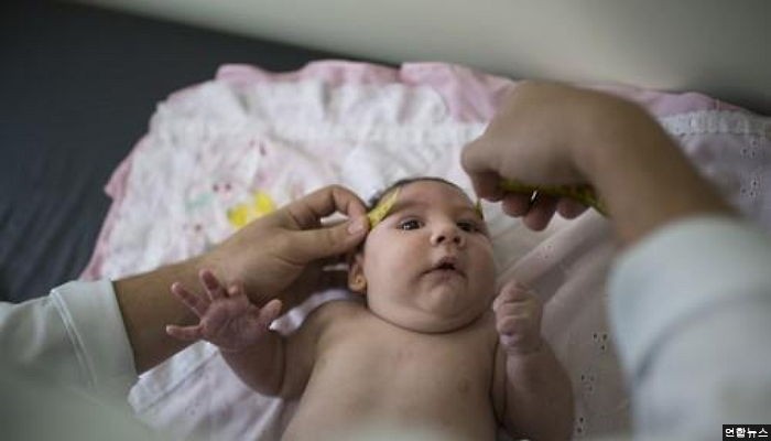 <속보> ‘소두증’ 지카 바이러스, 법정감염병으로 지정