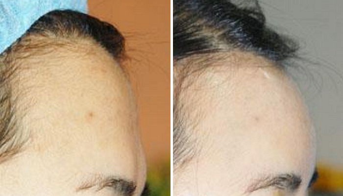 “공짜 성형 뒤 7년 홍보 모델은 지나치지 않다”