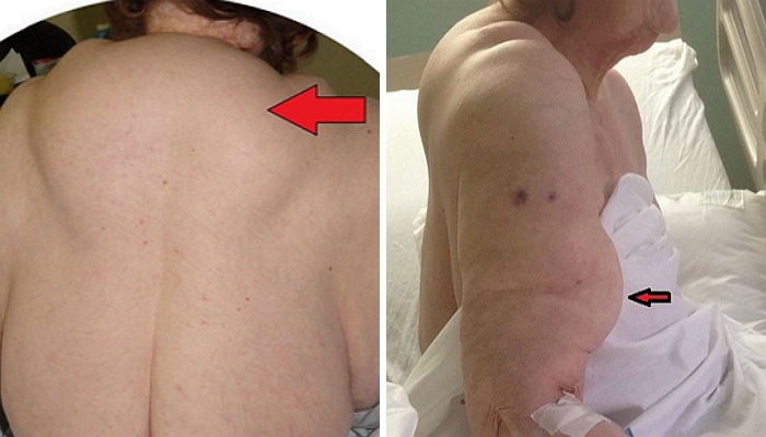 “40년 동안 술을 마신 여성의 몸은 이렇게 변했다” (사진)