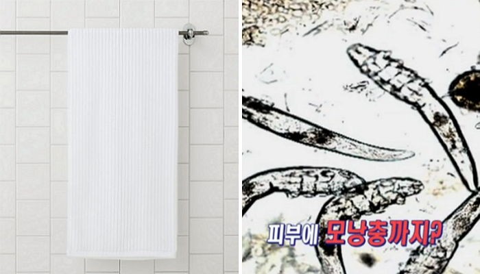 “수건 빨지 않고 쓰면 얼굴에 ‘모낭충’ 옮긴다”