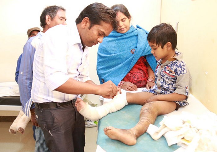 통증 느끼지 못해 자신의 손가락 뜯어먹은 아이