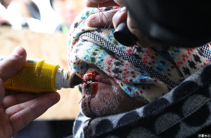 난민촌 퇴거명령 항의 위해 입 꿰멘 이란 난민들