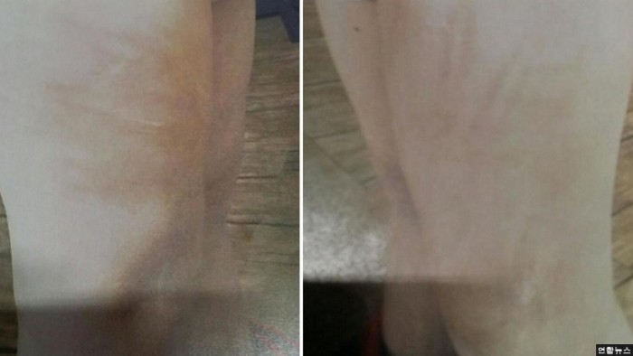 평택 실종 아동...학대 정황 보여주는 허벅지 사진