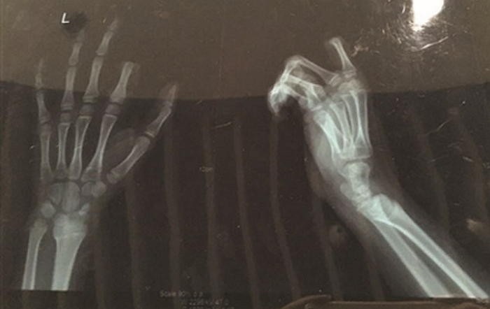 게임 그만하라는 아빠 꾸중에 손가락 자른 11살 아들