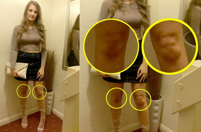 “내 무릎에 독재자 김정은 얼굴이 나타났어요”