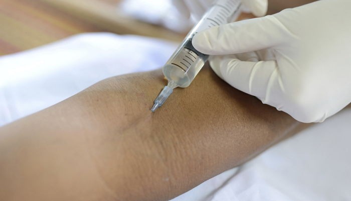 “정신병 치료를 위해 입원시킨 아들이 병원에서 죽었습니다”