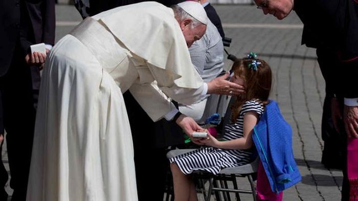 시력 잃어가던 소녀 “눈멀기 전 만나고 싶은 사람이 있어요”