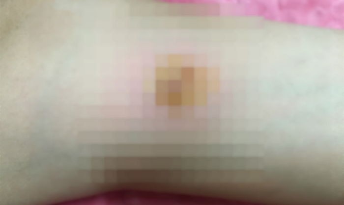 “주인집 강아지가 몸이 불편한 우리 아이를 물었어요”