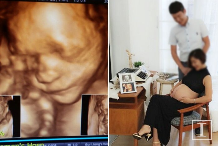 건강했던 아기는 산부인과에서 심장이 멈춘 채 태어났다