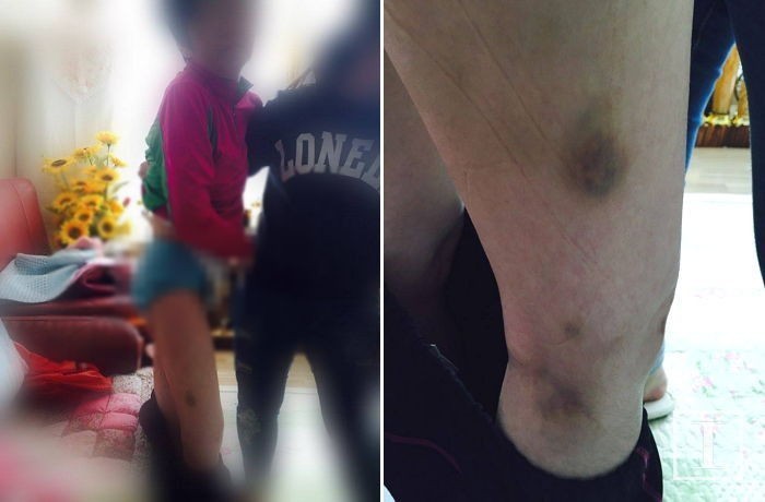 “장애 1급 어머니가 요양병원서 ‘성추행’ 당했습니다”