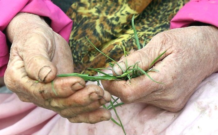 ‘치매’걸린 노인이 아들 주려고 끝까지 꼭 쥐고있던 것
