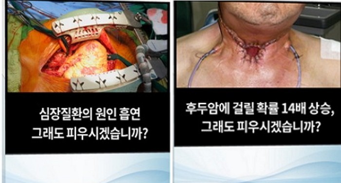 시민 5명 중 1명 “담뱃갑 경고 그림, 너무 혐오스럽다”