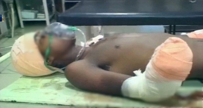 생후 7개월 딸 성폭행한 범인 양손 자른 아버지