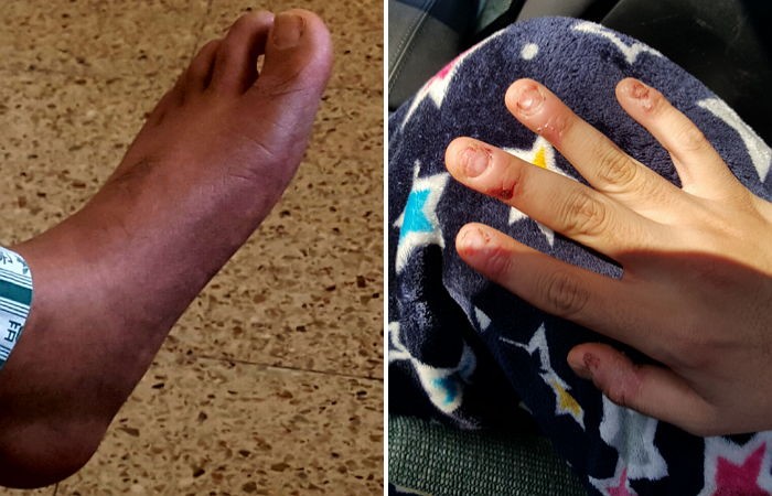 “군대에서 억울하게 장애인된 아들을 도와주세요”