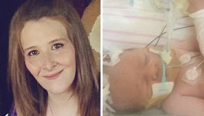 교통사고로 죽어가던 엄마는 배 속 아기를 살려냈다