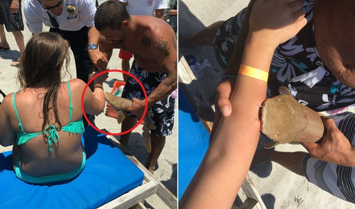 수영하다 상어에 물린 여성은 녀석과 함께 병원으로 갔다