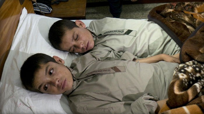 해만 지면 식물인간으로 변하는 형제의 사연