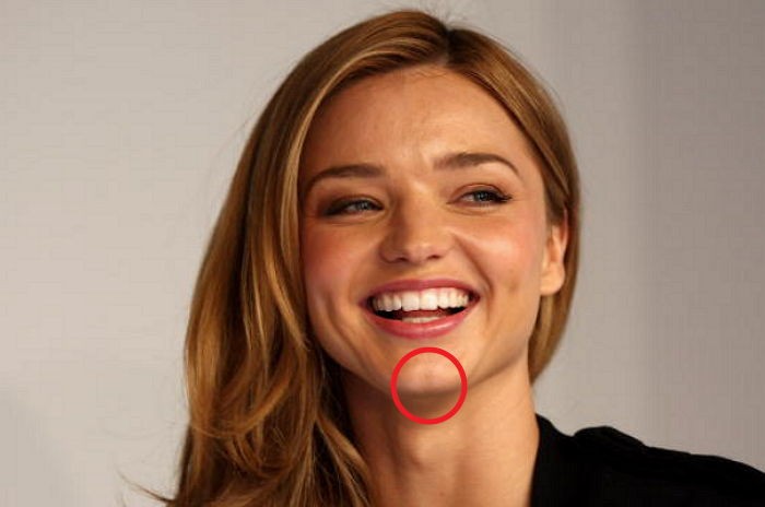 얼굴에 ‘턱 보조개’ 있는 사람들의 공통적 특징