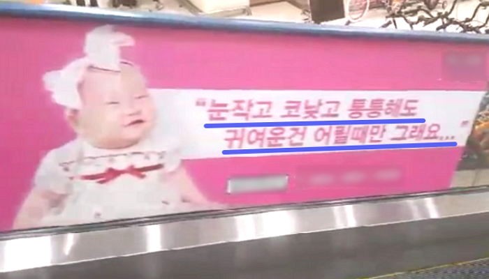 갓난아기 외모 비하한 성형외과 광고 논란