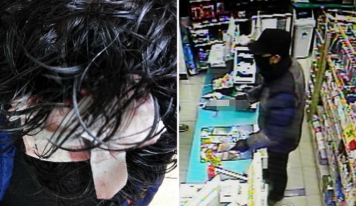 “저를 망치로 내리친 강도가 고등학교 동창이었습니다”