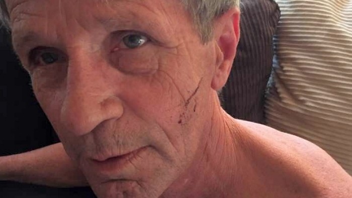 산책 중 만난 거대 야생 곰 맨주먹으로 물리친 60대 노인