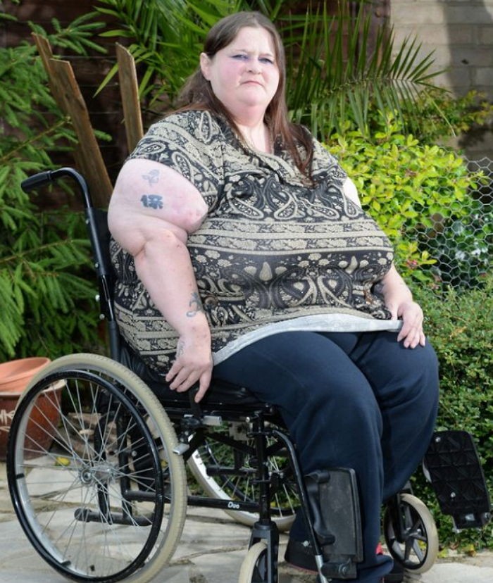 정부에 ‘가슴 축소’ 수술비 지원 요구한 비만 여성