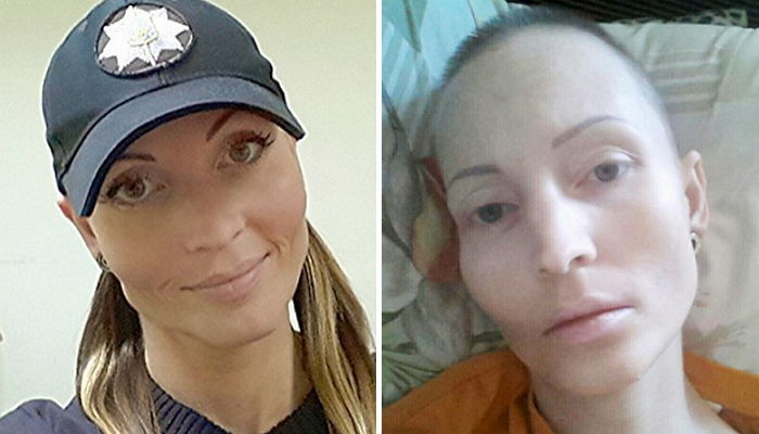 체포한 범죄자가 뱉은 ‘침’ 맞고 병 걸려 죽은 여경