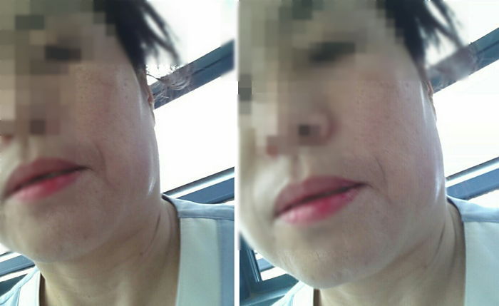 “저희 엄마가 딸 뻘되는 간호사에게 뺨 맞았습니다”