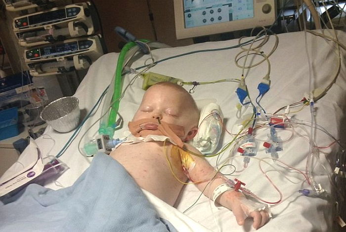 수두인 줄 알았다가 ‘시한부’ 판정 받은 19개월 아기