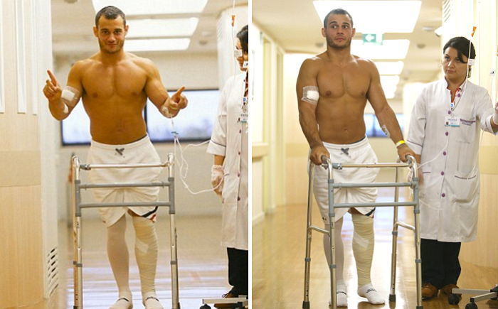 올림픽 경기 중 정강이 부러진 체조 선수 재활 시작했다