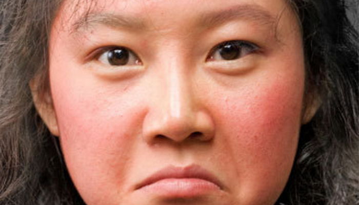 지긋지긋한 안.면.홍.조 없애는 꿀팁 5가지