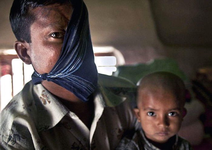 호랑이에게 공격 당해 얼굴 절반 잃은 남성 (사진)