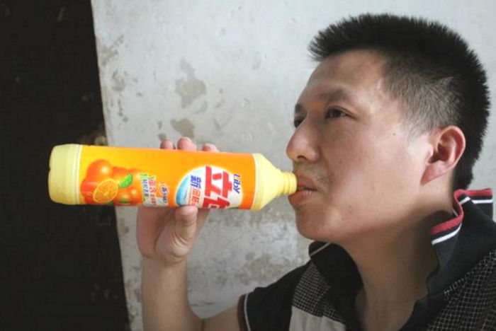 4년 동안 매일 ‘세제 반병’ 마시는 남성