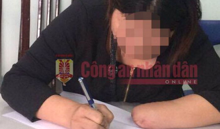 보험금 ‘1억 6천만원’ 받으려 손·발 직접 자른 여성