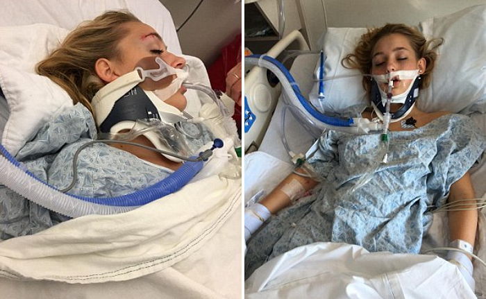 밤새 ‘술’ 마셨다가 혼수상태 빠진 15살 소녀