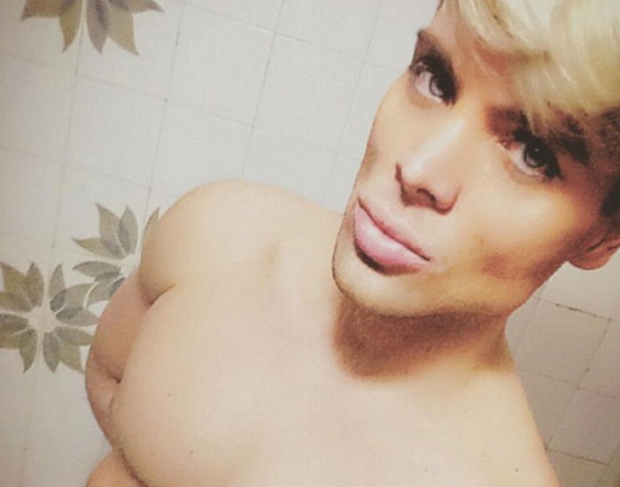 남자 바비 ‘켄’되려고 갈비뼈 제거 수술하는 남성 (사진)