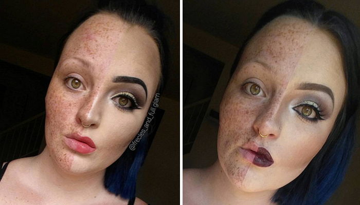 메이크업으로 ‘주근깨’ 완벽 커버한 여성의 비포&애프터