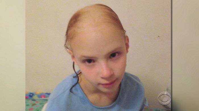 헤어 컨디셔너 3번 사용했다가 ‘대머리’ 된 11살 소녀