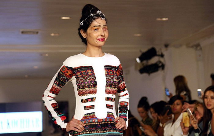 ‘염산테러’로 눈 잃은 소녀가 뉴욕패션위크에 나섰다