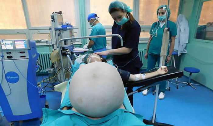 뱃속에 30kg짜리 거대 종양을 품고 있던 여성