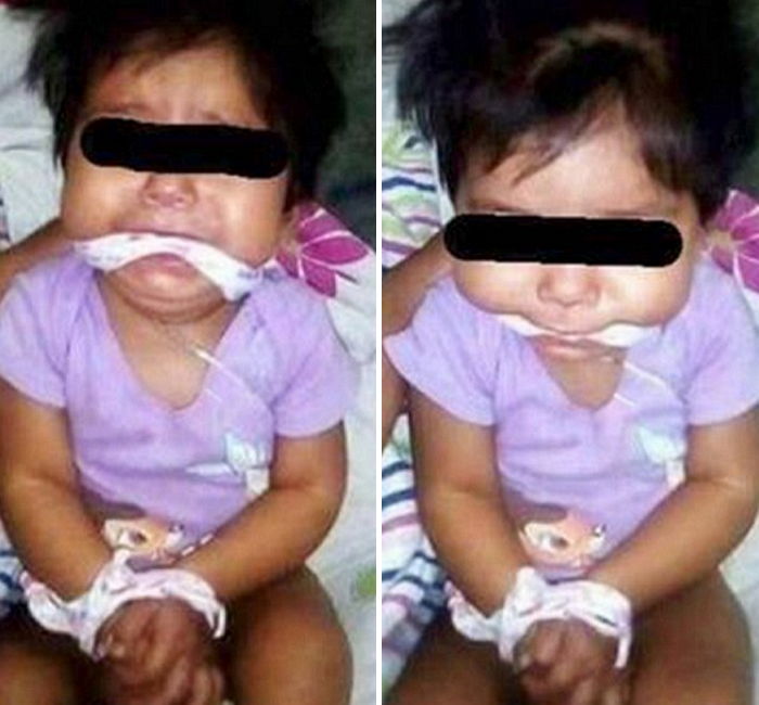 페이스북 ‘좋아요’ 받으려고 딸 학대 사진 올린 엄마