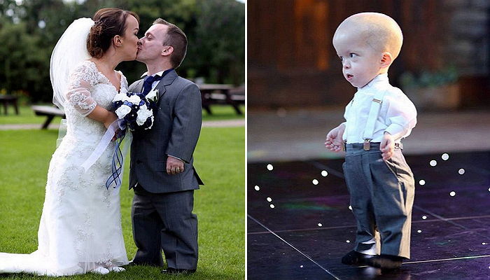 시한부 판정 받은 아들 위해 결혼식 올린 ‘왜소증’ 부부