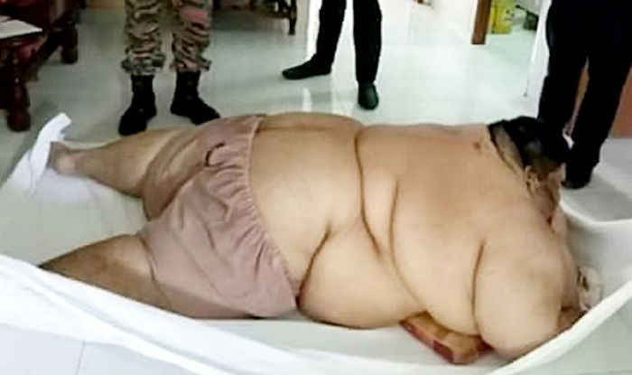 국수 30그릇 먹다가 응급실 실려간 300kg 남성