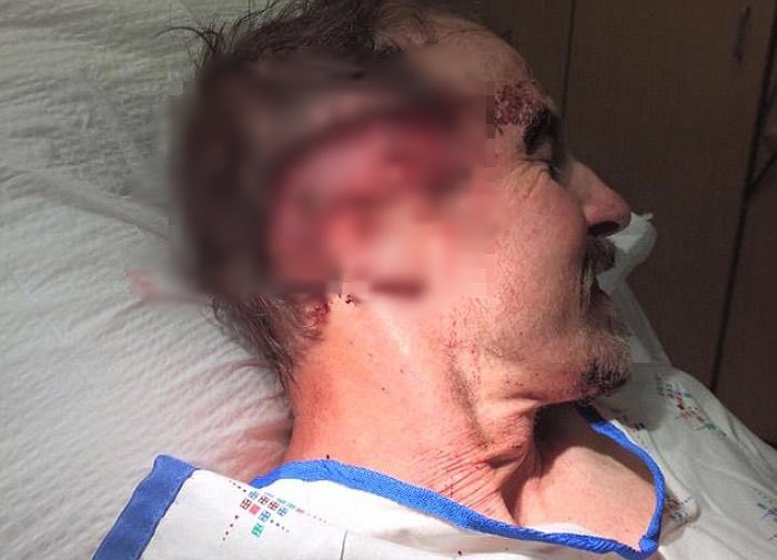 ‘회색곰’과 사투 벌이다 살아 돌아온 남성의 생존 비법