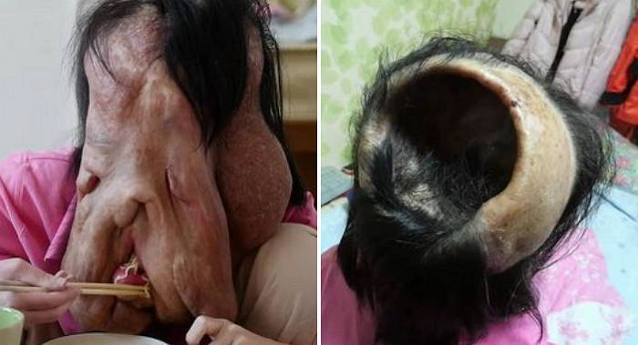 안타까운 현희씨 사연에 시민들은 밤사이 3억원을 기부했다