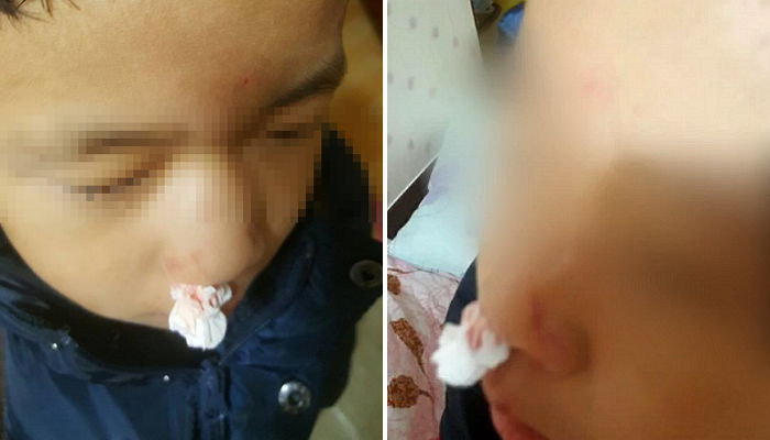 5살 아이 땅에 내동댕이치고 폭행한 유치원 보육교사 (영상)